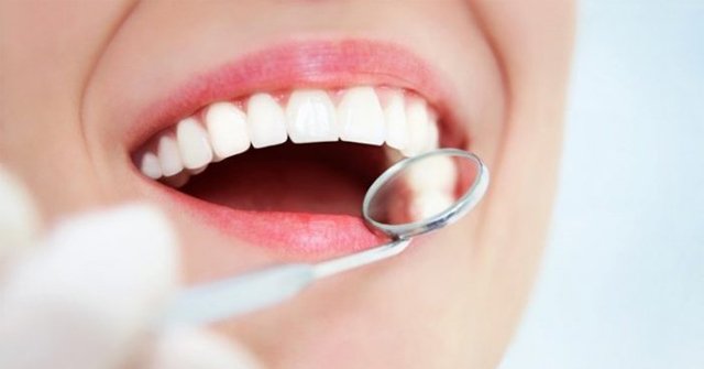 Bọc răng sứ xong chăm sóc và dọn dẹp vệ sinh làm thế nào cho đúng chuẩn?